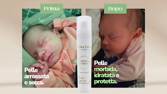 Cambio pannolino frequente: come proteggere la pelle delicata del bambino