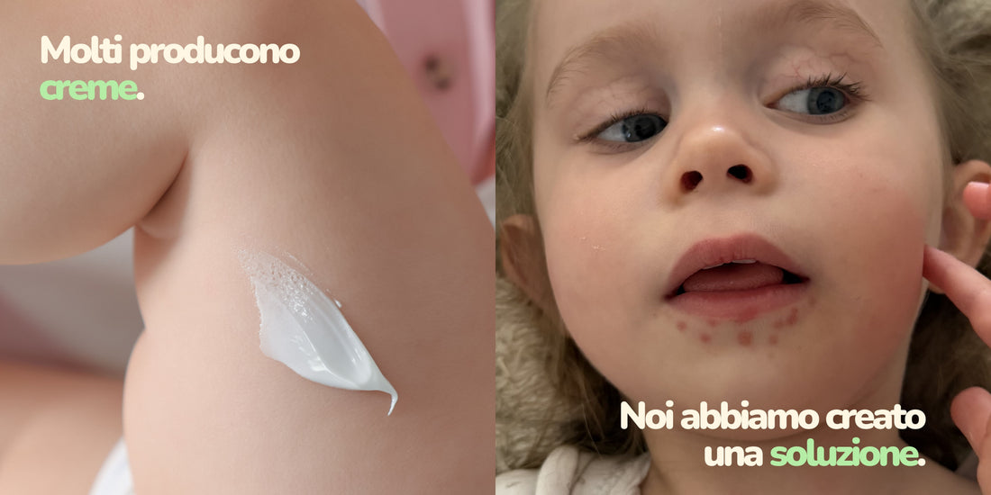 Perché la pelle del neonato si arrossa? Cause e consigli per proteggerla